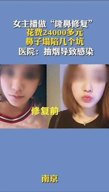 韩国女主播鼻子塌陷,揭秘明星整形背后的真相